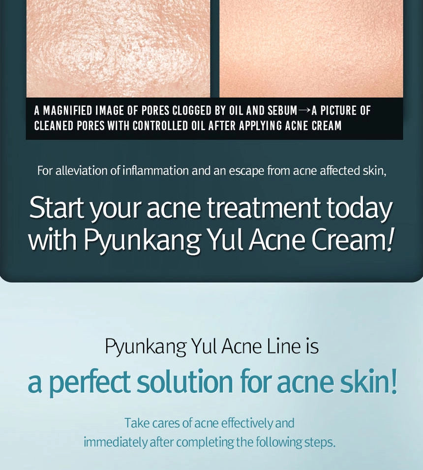 Pyunkang Yul - Acne Cream 50ml